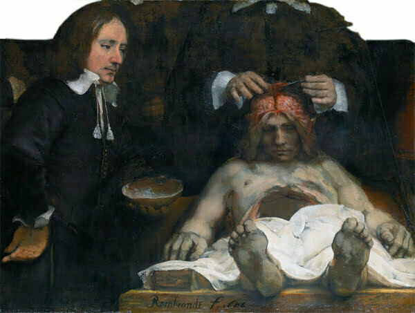Rembrandt (1606-1669) Title The anatomy lesson of Dr. Joan Deyman.Date 1656, Command Undead